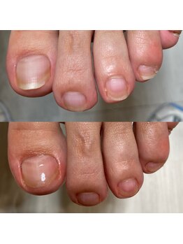 爪ケア・爪ピカピカコース