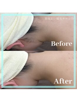 TD 一宮店/襟足Before→After