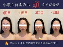 エレミュー 烏丸(Elemue.)/究極の小顔　5回目／10回コース