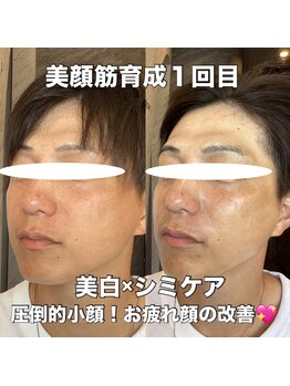 リエル(RIEL)/【美顔筋育成】