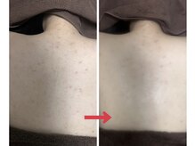 スリリアン 銀座/★お客さまビフォーアフター