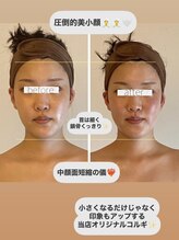 パル コルギサロン(Pal. Korugi salon)/コルギビフォーアフター