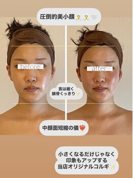 パル コルギサロン(Pal. Korugi salon)/コルギビフォーアフター