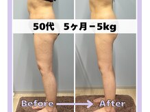 ベルミーランド 浜松天王/痩身Before→After