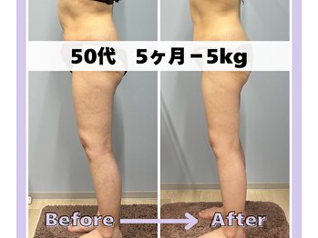 ベルミーランド 浜松天王/痩身Before→After