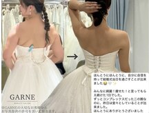 ガーネ(GARNE)の雰囲気(ビフォーアフター写真&ブログ掲載中!【小顔×痩身/ブライダル】)