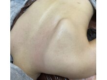 アメジスト(amethyst)の雰囲気（花嫁ブライダル痩身（肩甲骨出し）もお任せ！）