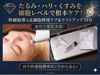 エターナル(Eternal)の写真