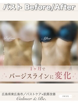 カルマーアンドビー(Calmer & Be.)/【バスト】Before/After