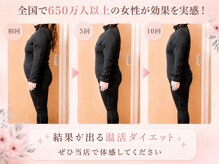 ヨサパーク ビリュウ(YOSA PARK Bellyu)