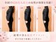 ヨサパーク ビリュウ(YOSA PARK Bellyu)の写真