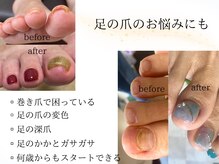 ナンバーアンドスリーサン(No&33)の雰囲気（巻き爪ケアと足元ケア、余分な角質を除去して赤ちゃん肌に）