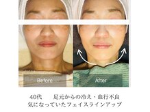 40代【悩み】血行不良、フェイスラインが気になっていました