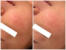 メゾンリュバン 梅田店(Maison Ruban)/ララピール|ツヤ肌