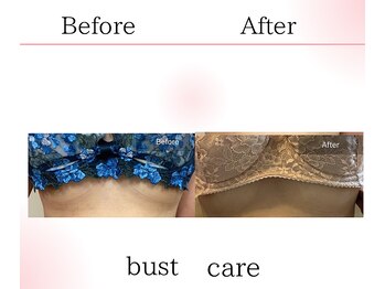 サロンツキ(salon tuki)/バストアップ/バストケア/徳島