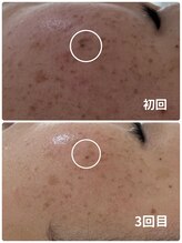 ベルエクラ(Bel Eclat)/毎日お肌を見るのが楽しくなった