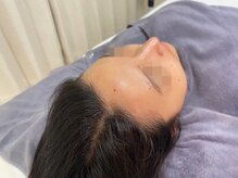 グレース 吉祥寺(grace)/ミネラル水光肌 天然 艶玉吉祥寺