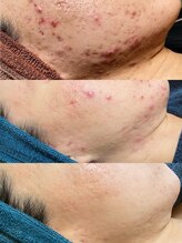 ソリッジ肌管理室/TIPサイエンスコントロール