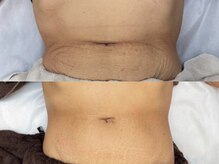 エモーショナル 姫路(Emotional)/3回目◎エステ版オンダ