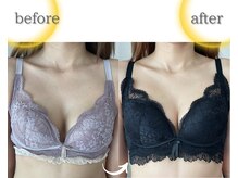 ラジュワード(lajward)/バストケア　before→after