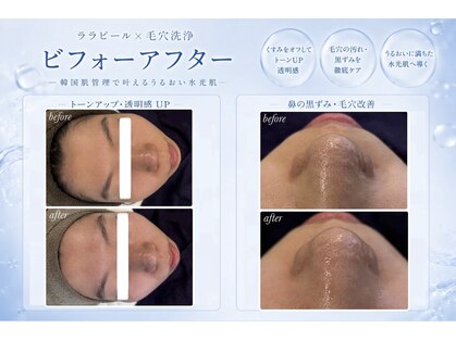 セローナ(Selona)の写真