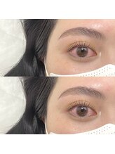 フランセス(Frances)/ラッシュリフト