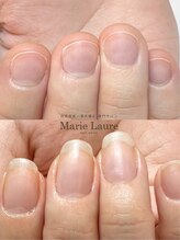 マリーロール 梅田店(Marie Laure)/自爪育成/深爪矯正/ネイルケア
