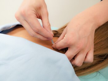 すかい鍼灸整体院の写真/【ラジオで紹介★】手技&マシンで改善しない頑固で重だるい肩こり腰痛もしっかり解消!驚きの軽やかBodyに♪