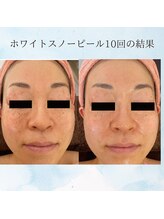 マリー エクラン/