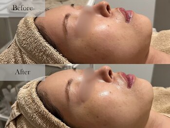 シェリーミル(Cherie Miru)/くすみ/美白/毛穴/シミ