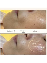 プリオール 太田店(Prior)/エステダーマ×幹細胞