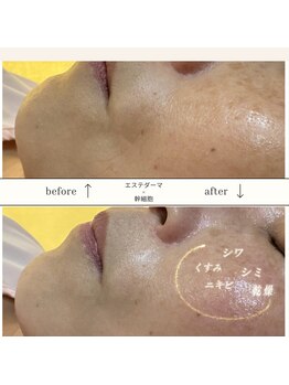 プリオール 太田店(Prior)/エステダーマ×幹細胞