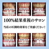 【歯科提携】歯のホワイトニング専門店 ホワイトニングサロン宝塚