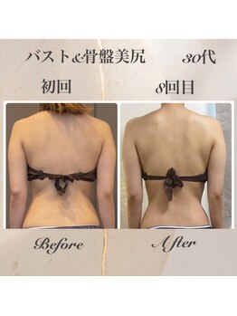 リリー(Lily)/ビフォーアフター