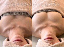 エメ(Aimee)の雰囲気(一度でも効果実感◎サイズUPはもちろんハリ感も形も満足の結果!)