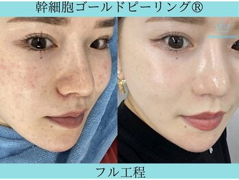 リメイククリニカルビューティー(Remake clinical beauty)/