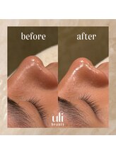 ウリ(uli beauty)/比較写真