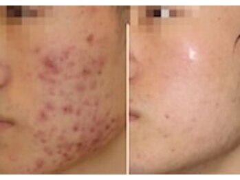 スリリアン 銀座/★お客さまビフォーアフター★