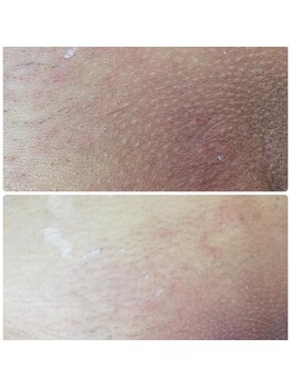 アットユウ(@yu)/フェムエステ