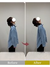 リン 高崎院(RIN)/Before/After