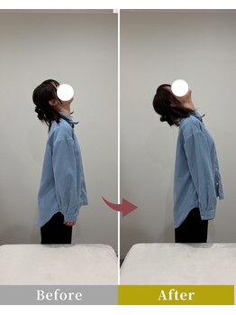 リン 高崎院(RIN)/Before/After