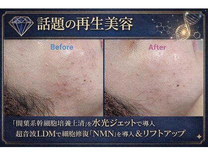 エターナル(Eternal)の写真