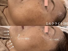 サロンヴェアリー 広尾(salon vary)/ミルクライト1回