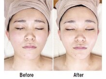 サロンミッシェル(Salon Michel)の雰囲気（あなたのお悩みに合わせた矯正でスッキリとしたフェイスラインへ）