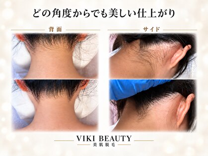 ヴィキ 北千住(VIKI)の写真
