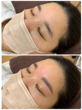 ラ フルール(La Fleur)/ハリウッドブロウリフト