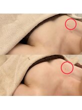 IBC 横浜馬車道店/Before-After