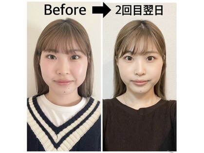 癒しの温活ダイエットMoRinga Beauty Salon.