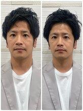 長寿鍼灸院 長寿整骨院/men's美容鍼50本効果★