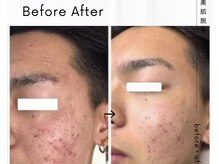 エミナル(EMINAL)/本気の肌質改善(MEN'S)